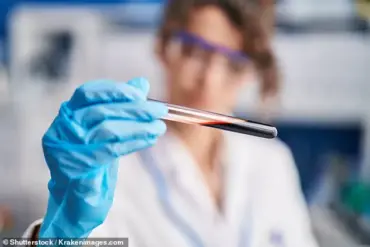 Breakthrough Study Identifies Biological Cause of Excessive Daytime Sleepiness, Challenging Previous Assumptions