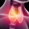 Thyroid Disease and Women's Health: Experts Explore Non-Pharmaceutical Interventions